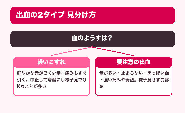 出血の2タイプ 見分け方